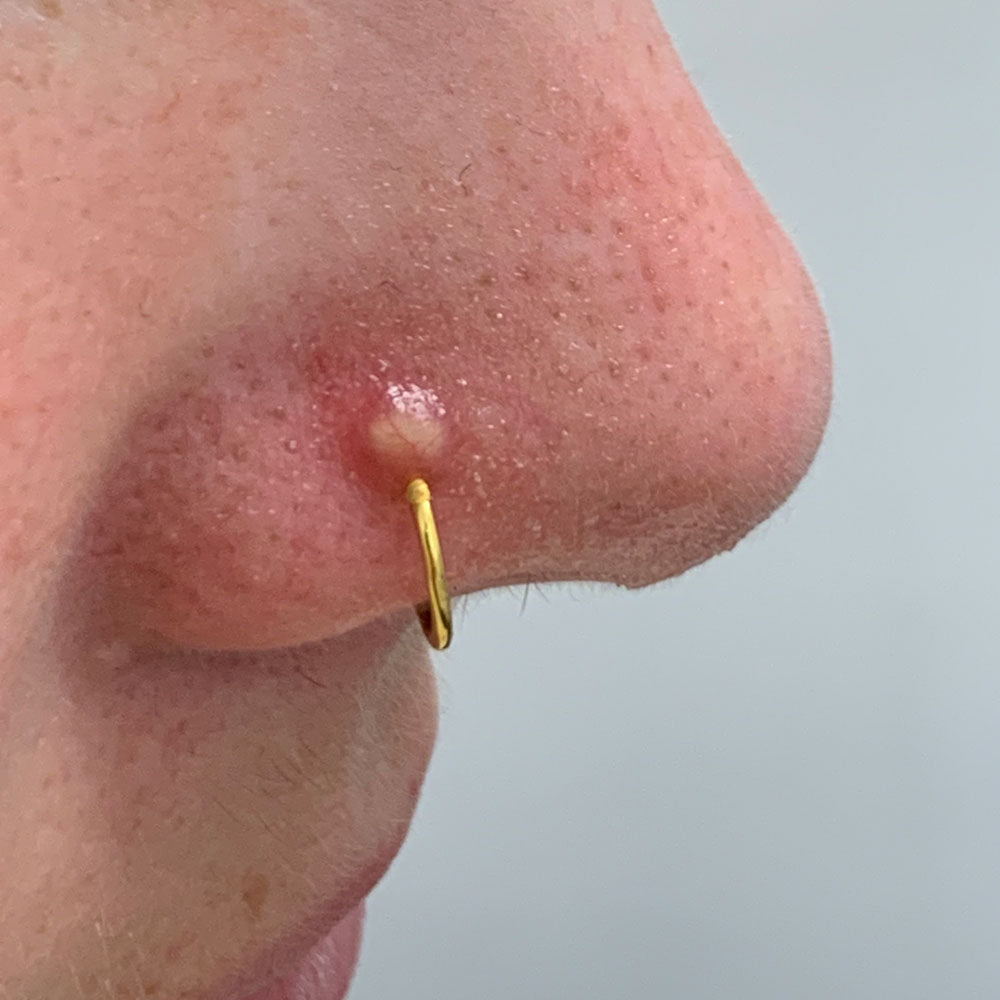 Silikondisk mot bulor och keloider - Hjälpmedel för irriterade piercingar